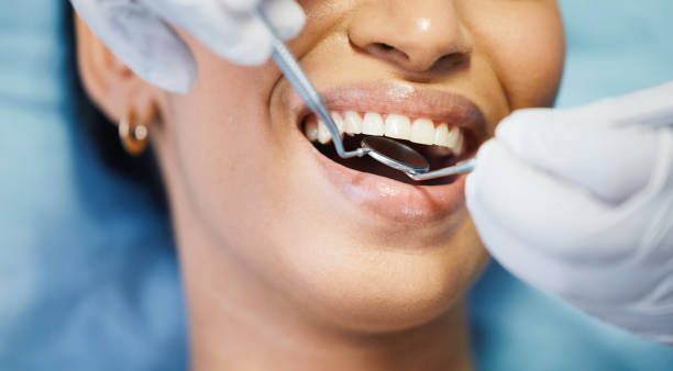 Professional Dental Services in La Mirada, CA